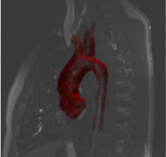 Figure 3.3: The volume reconstructed within the Volume 3D feature (in red) gives an idea of the quality of the reconstruction