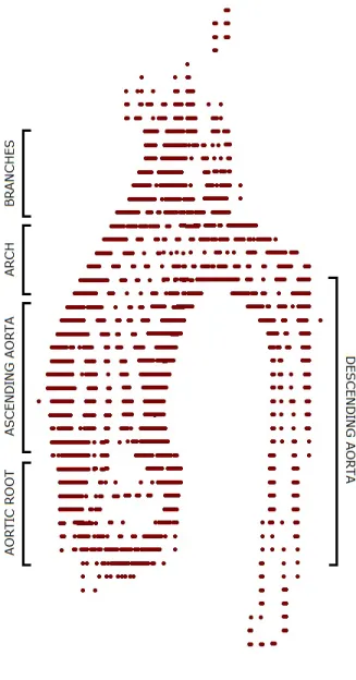 Figure 3.4: The cloud made of 1955 points. The shape of the aorta can be distinguished, in this projection, among all of the segmented parallel slices.