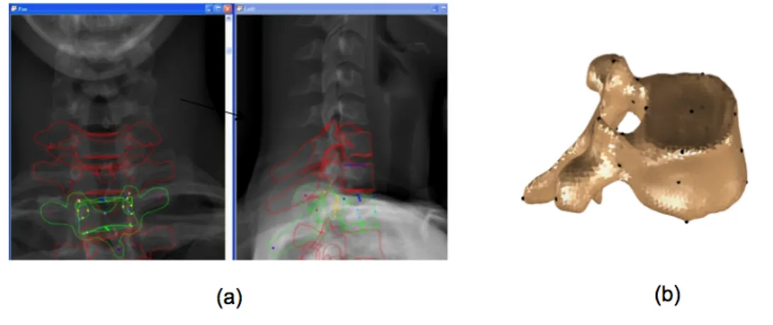 Figure 1-13 : Reconstruction 3D à partir du système EOS : (a) interface du logiciel de reconstruction sterEOS (EOS  imaging), (b) modèle 3D d’une vertèbre (avec les repères anatomiques) 