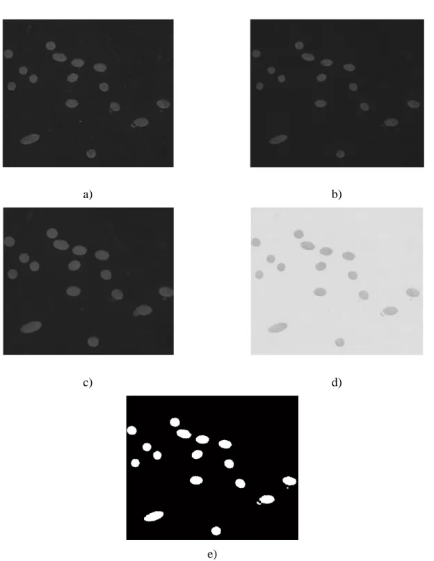 Figure 3-14 : Image obtenue au cours des différentes étapes de la binarisation :  a) image originale, b) image érodée, c) image dilatée,  