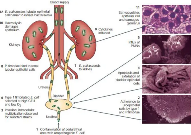 Figure 2: Pathogenesis of urinary tract infection caused by uropathogenic E. 