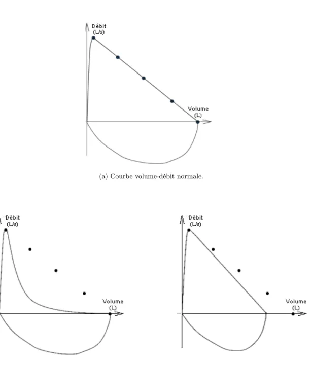 Figure 1.2 – Courbes volume-débit. Les images proviennent de [76].