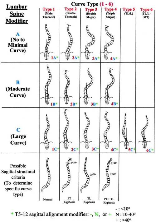 Figure 1.10: Classification de Lenke (Lenke, 2001)