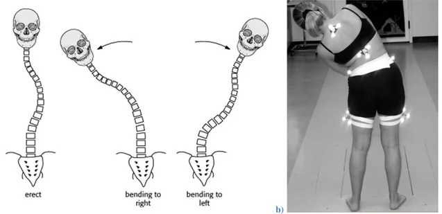 Figure 1.17: Test d'inflexion latérale maximale volontaire a) Selon UW Radiology et b) Selon medscape 