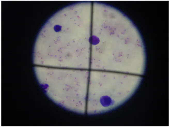Figure 3.1: High power microscopic eld.