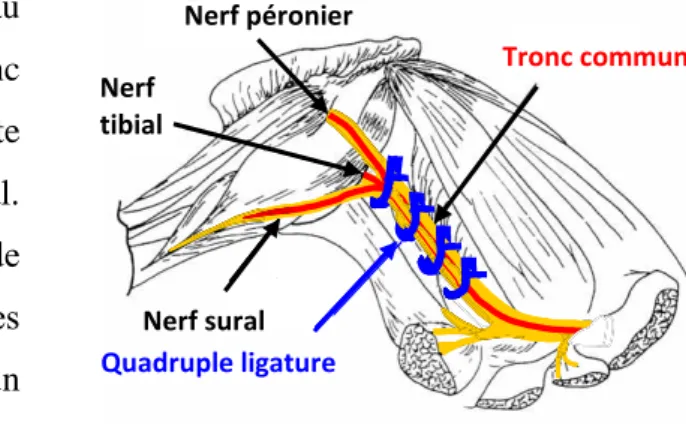 Figure 15 :  Ligatures du nerf sciatique