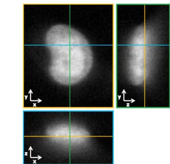 Figure 1.2: Axis-dependent slices of a 3D image showing a cell nucleus. (top) XY slice of the image