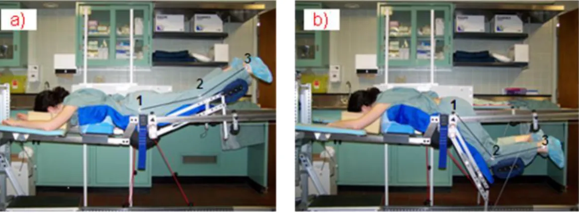 Figure 3.3 (A2F1): MFPF Leg Positioner; Extended (A) and flexed (B) positions 