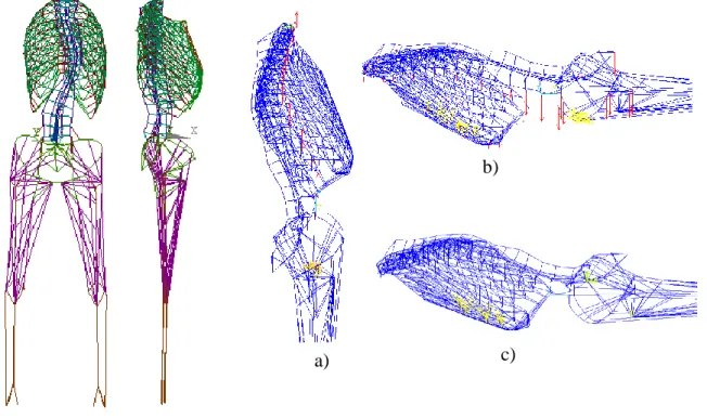 Figure 3.2 (A1F2): PA and Lateral Views of the developed FEM along with the three phases of  the prone positioning simulations (patient #1): a) vertical application of forces equivalent to trunk  segmental, head, shoulder and upper limb weights; b) AP application of forces equivalent to trunk 