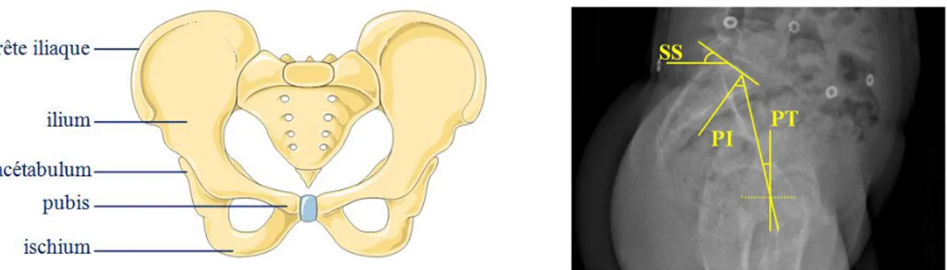 Figure 2.4 : Vue antérieure d'un bassin féminin (Image libre de droit, adaptée de smart.servier.fr)  et les paramètres pelviens sur une radiographie en vue latérale : incidence pelvienne (PI), 