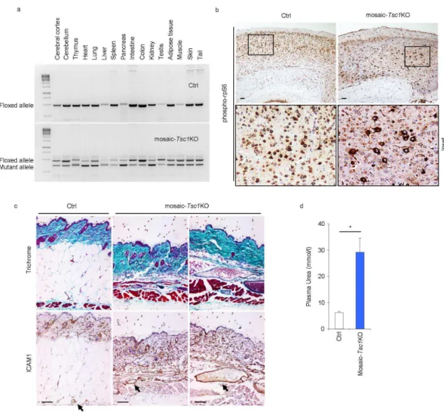Figure  3.  Mosaic-Tsc1KO  mice  develop  multisystem  lesions  showing  similarities  with  human  TSC