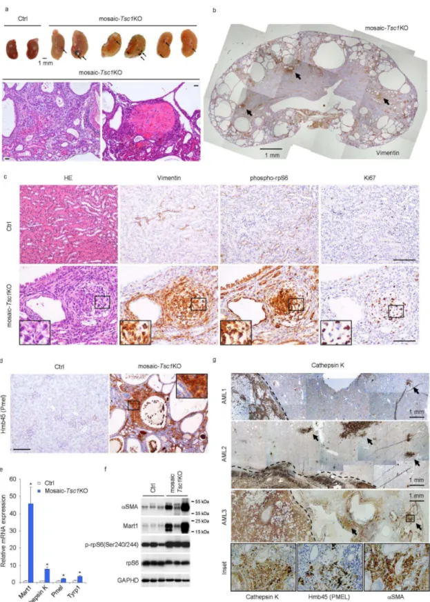 Figure  4.  Mosaic-Tsc1KO  mice  develop  renal  mesenchymal  lesions  recapitulating  PEComas  associated with human TSC