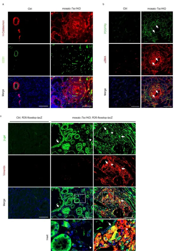 Figure  5.  Mosaic-Tsc1KO  mice  develop  renal  H-caldesmon +   mesenchymal  lesions  containing 