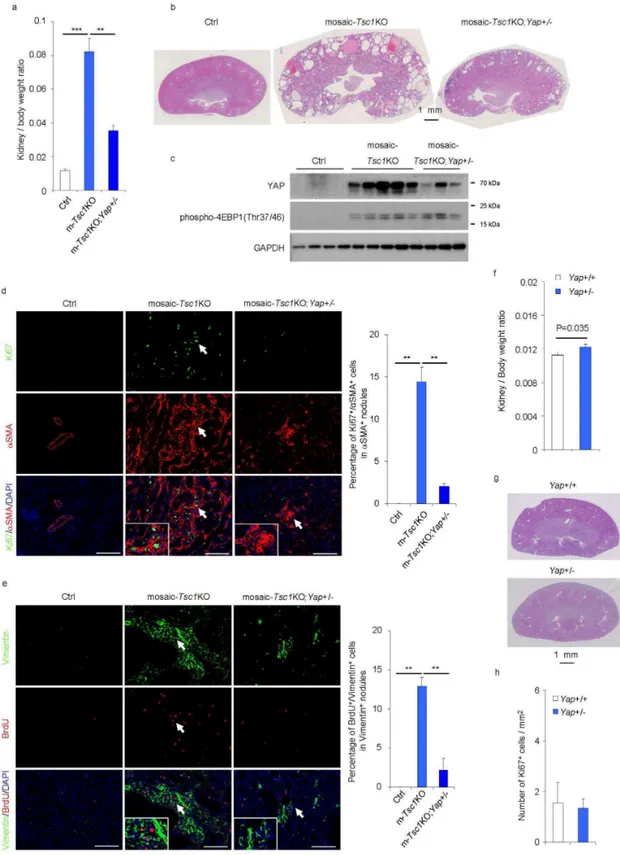 Figure 11.  Heterozygous deletion of Yap compromises the proliferation of renal mesenchymal  lesions  in  mosaic-Tsc1KO  mice