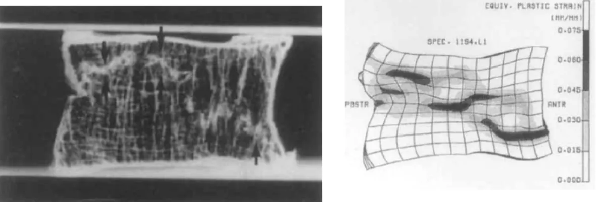 Figure 1.23 : Comparaison entre les radios et le MEF de tranches de vertèbres (Silva et coll