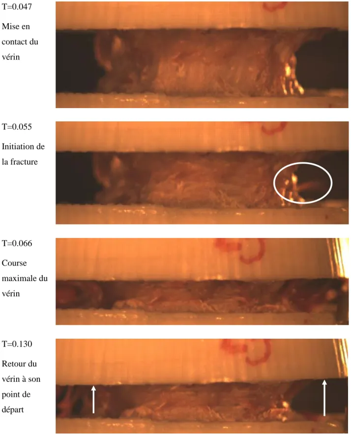 Figure  3.15  : Réponse caractéristique du corps vertébral en compression -  vue antérieure  (spécimen 117-L3) 