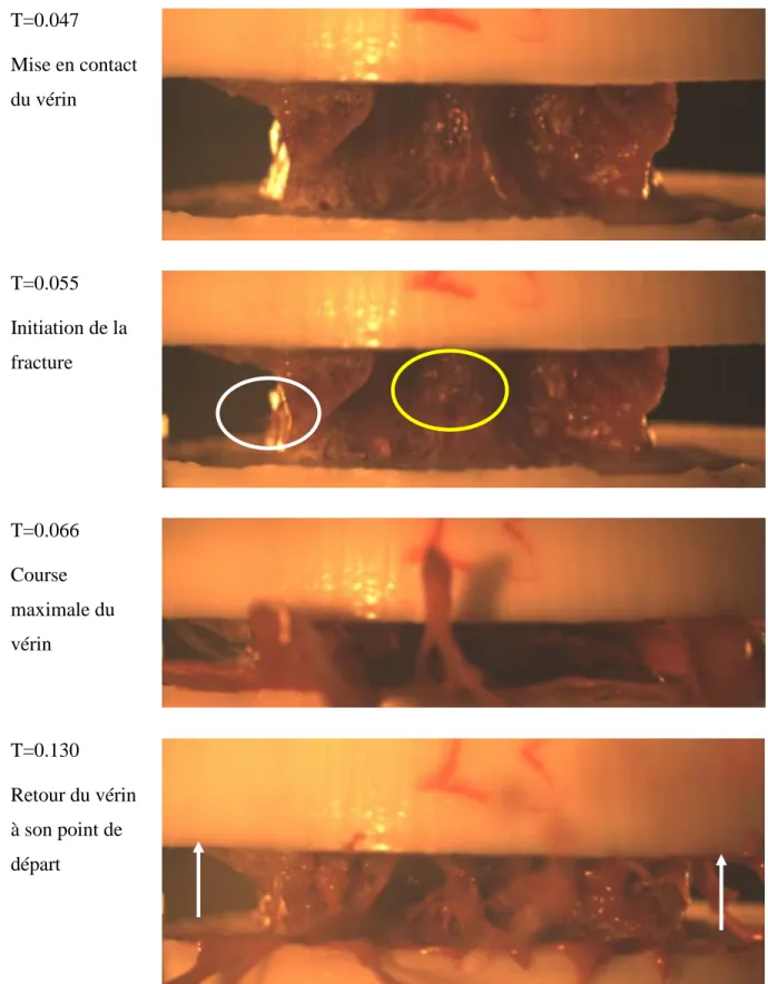 Figure  3.16  : Réponse caractéristique du corps vertébral en compression -  vue postérieure  (spécimen 117-L3) 