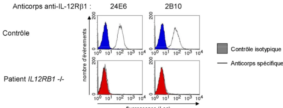 Figure 4: Phénotype cellulaire par FACS des patients avec un déficit complet en IL- IL-12R β1