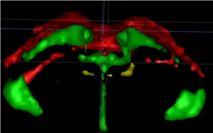 Figure  2.7.  Rendu  3D  de  la  segmentation  effectuée  sous  ITK-Snap  à  partir  d’images  T 2   haute  résolution