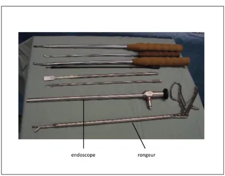 Figure 1.11 Les instruments et l’endoscope pour la chirurgie de la scoliose (Lonner et al., 2007)