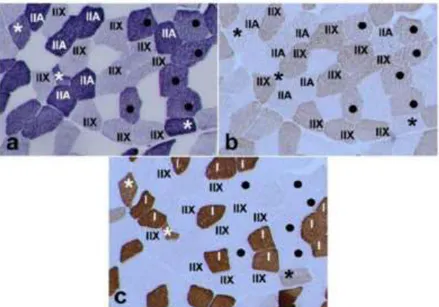 Figure 6.  Détermination des différentes typologies musculaires au sein du vaste latéral chez 