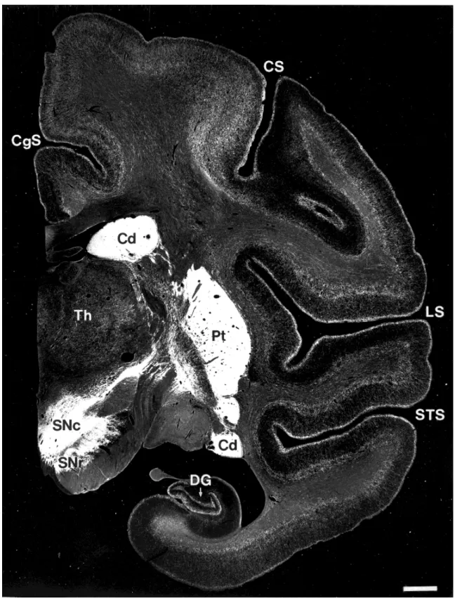 Figure  3.  Localisation  du  transporteur  de  la  dopamine  (DAT)  chez  le  singe. 