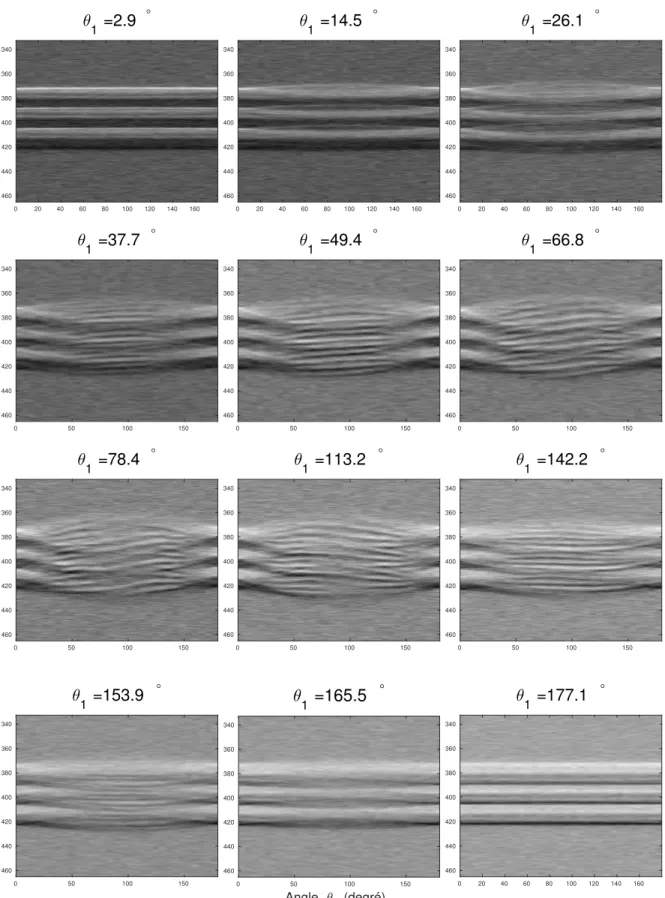 Figure 28 – Collection de sinogrammes 2D de la fusilli