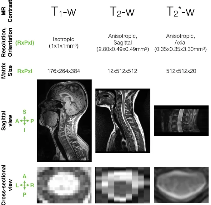 Figure 2.5: Samples of spinal MRI data. 