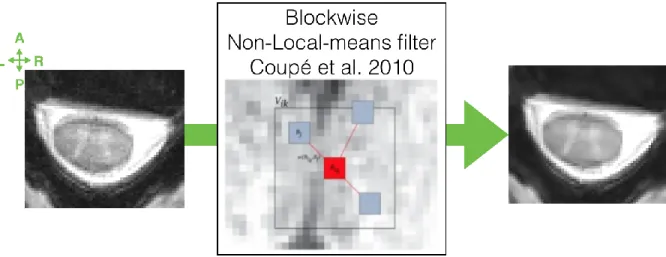 Figure 2.10: Block-wise Non-Local-means filter. 
