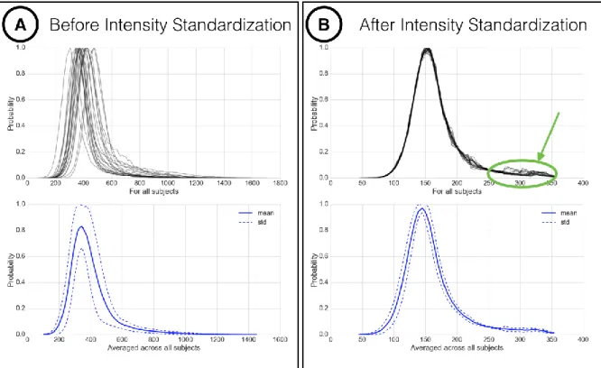 Figure 2.11: Intensity normalization proposed by Nyúl et al. 