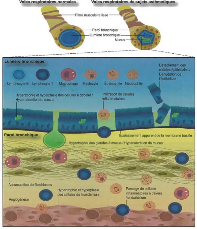 Figure 3 Représentation schématique des principaux mécanismes de remodelage bronchique dans  l’asthme ainsi que les principales cellules inflammatoires impliquées 