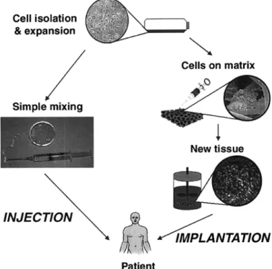 Figure 2-2: Schematic illustration of typical tissue engineering approaches. Cells are obtained  from a small biopsy from a patient, expanded in vitro, and transplanted into the patient either by  injection using a needle or other minimally invasive delivery approach, or by implantation at the 