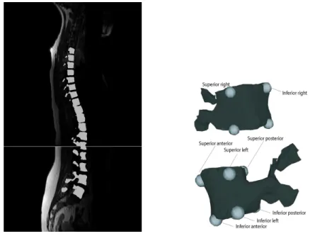 Figure 4.1 3D reconstruction of vertebrae from MRI sagittal slices along with manually labeled landmarks on each of the vertebrae.