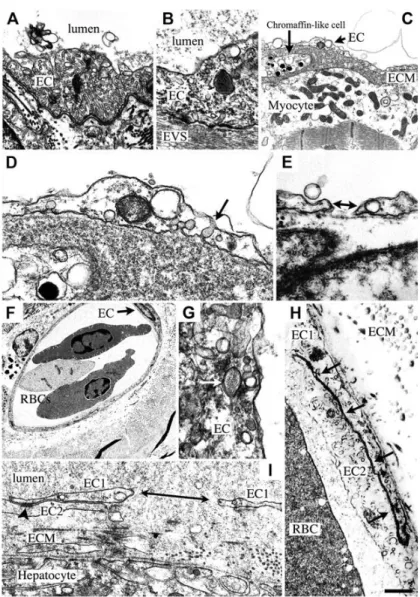 Figure 18 : Hétérogénéité structurale des endothéliums chez la myxine observée par microscopie  électronique