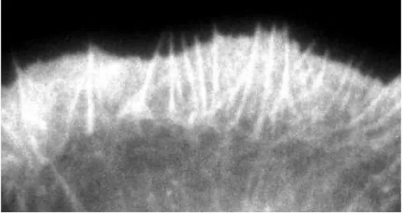 Figure 14 – Une cellule XTC marquée pour les filaments d’actine. On observe les filopodes ainsi que le lamellipode