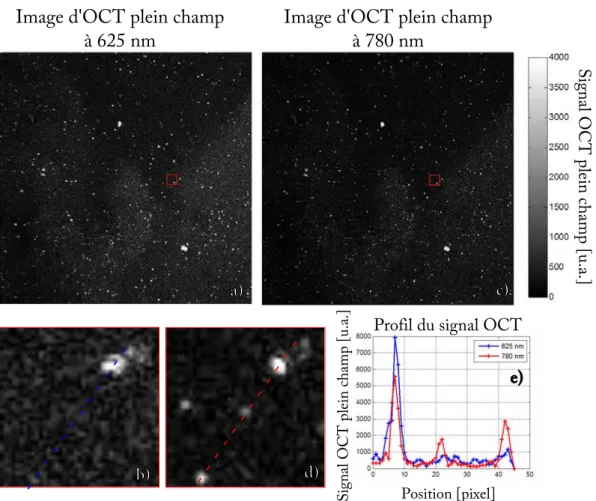 Figure 3.7 – Images d’OCT plein champ d’un gel d’agarose contenant des nanoparticules cœur-