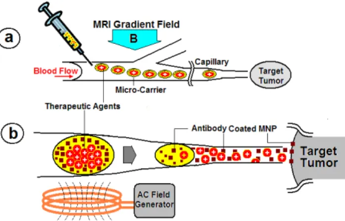 Figure 1.2: Illustration de l'effet du microdispositif injecté dans la circulation et guidé vers une  tumeur [5] 