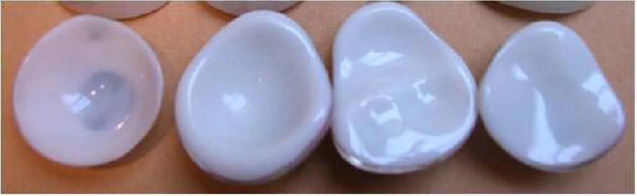 Figure 2-5 : Implant sphérique poreux fait de biocéramique 