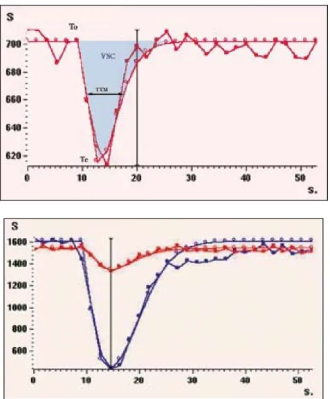 figure 3 : courbe du signal en fonction du temps au premier passage du produit de contraste  dans la séquence de perfusion en IRM