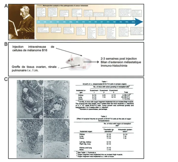 Figure 1: Pathogénèse de la métastase et théorie du « seed and soil » 