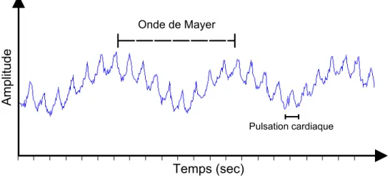 Figure 1.6: Signal typique SPIR