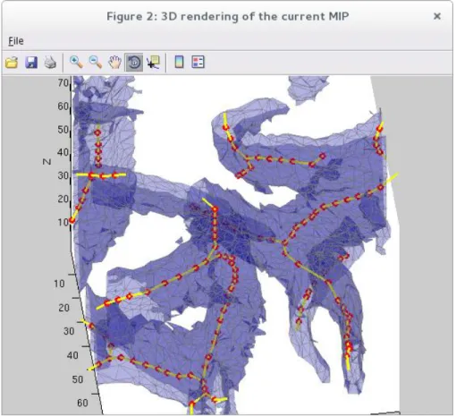 Figure 3.9 Exemple de vue 3D de la surface des vaisseaux sanguins 