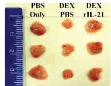 Figure 13 : Photographie représentative de thymus de souris après différents traitements:  injection de PBS, de PBS et de dexamethasone (DEX : hormone glucocorticoïde provoquant  l’apoptose cellulaire) ou de DEX et d’IL-21