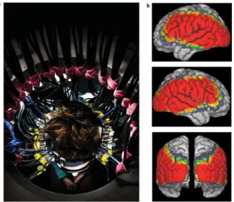 Figure 9 : dispositif d’acquisition en Tomographie  Optique  Diffuse  pour  le  cerveau  (a)  et  images  typiquement  obtenues  après  reconstruction