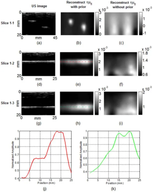 Figure 3.6: Representative images of the acquisition using phantom 1. The US images (a), (d), 