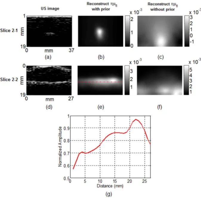 Figure 3.8: Representative images using phantom 2. The US images (a) and (d), the fluorescence 
