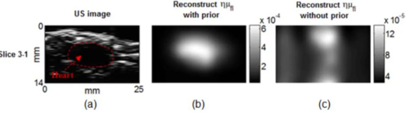 Figure 3.11: Representative images of slice 3-1 of the mouse: (a) The US image shows the heart 