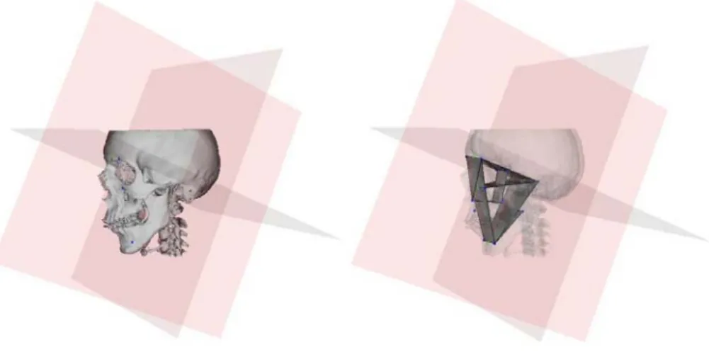 Figure 1: The craniofacial referential, and a 3D analysis example. 