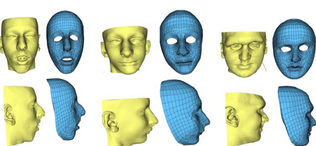 Figure 4. Three models of patients with different morphologies. Each model is quasi- quasi-automatically built in about 15 minutes 