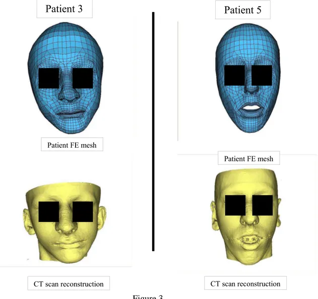 Figure 3CT scan reconstructionPatient FE mesh  Patient 5 Patient 3 CT scan reconstructionPatient FE mesh